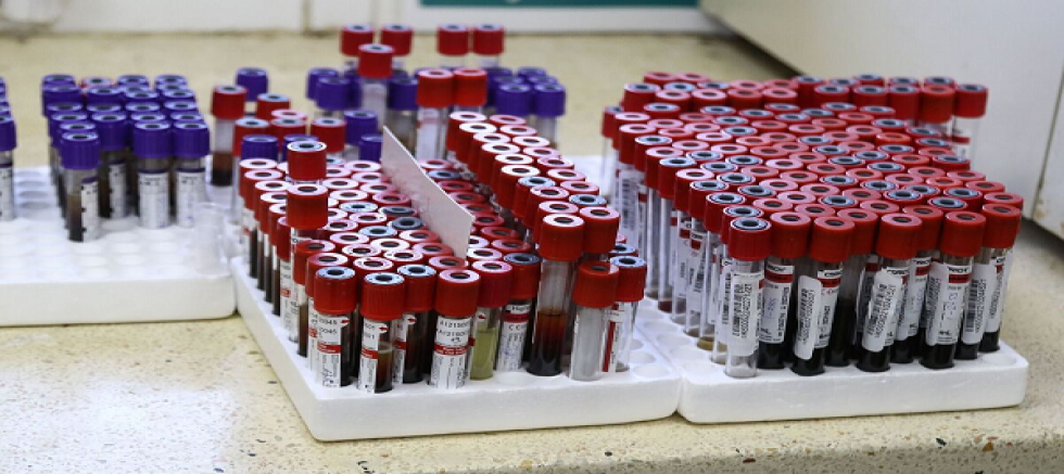 Sağlık: Kanserde Kandan Erken Tanı Mümkün Olabilir.