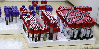 Sağlık: Kanserde Kandan Erken Tanı Mümkün Olabilir.